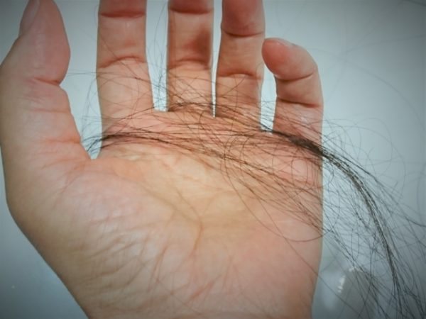 ミノキシジルの副作用のひとつ初期脱毛とは？