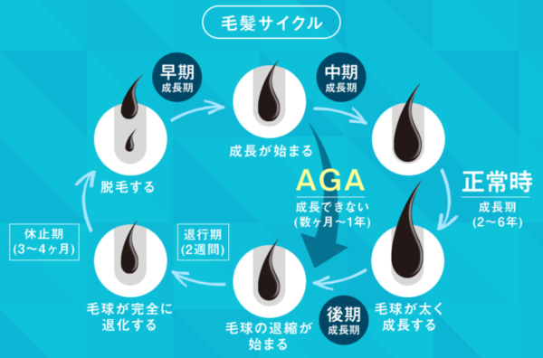 AGAのサイクル(AGAスキンクリニック引用)